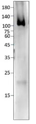 Anti-PDE2A antibody used in Western Blot (WB). GTX14605