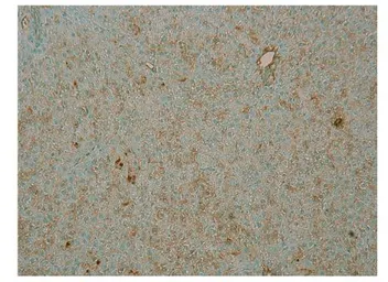 Anti-PDE4B antibody used in Immunocytochemistry/ Immunofluorescence (ICC/IF). GTX14611