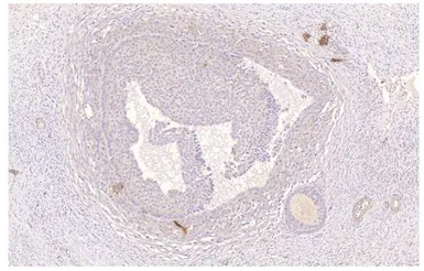 Anti-PDE4D antibody used in IHC (Paraffin sections) (IHC-P). GTX14613