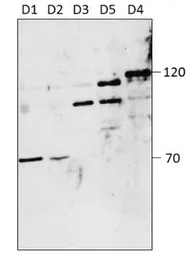 Anti-PDE4D antibody used in Western Blot (WB). GTX14613