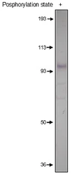 Anti-PDE4D antibody used in Western Blot (WB). GTX14613