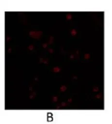 Anti-PDE4B3 antibody used in Immunocytochemistry/ Immunofluorescence (ICC/IF). GTX14615