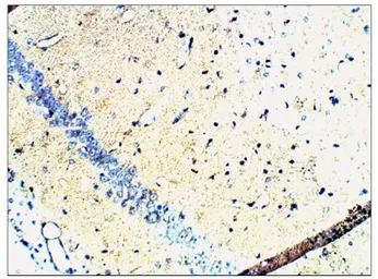 Anti-Synaptophysin antibody used in IHC (Paraffin sections) (IHC-P). GTX14692