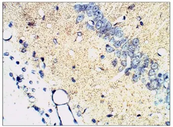 Anti-Synaptophysin antibody used in IHC (Paraffin sections) (IHC-P). GTX14692