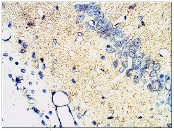 Anti-Synaptophysin antibody used in IHC (Paraffin sections) (IHC-P). GTX14692