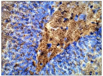 Anti-Synaptophysin antibody used in IHC (Paraffin sections) (IHC-P). GTX14692