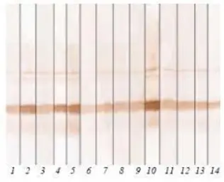 Anti-Calcitonin antibody [13g11] used in Western Blot (WB). GTX14819