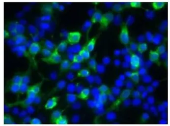 Anti-Bestrophin antibody used in Immunocytochemistry/ Immunofluorescence (ICC/IF). GTX14927