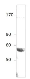 Anti-Bestrophin antibody used in Western Blot (WB). GTX14927