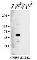 Anti-Carbonic Anhydrase IX antibody used in Western Blot (WB). GTX15086