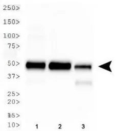 Anti-Carbonic Anhydrase IX antibody used in Western Blot (WB). GTX15086
