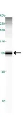Anti-Carbonic Anhydrase IX antibody used in Western Blot (WB). GTX15086