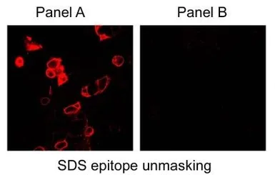 Anti-Carbonic Anhydrase IX antibody used in Immunocytochemistry/ Immunofluorescence (ICC/IF). GTX15086