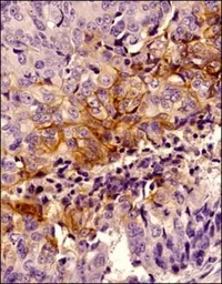 Anti-Carbonic Anhydrase IX antibody used in IHC (Paraffin sections) (IHC-P). GTX15086