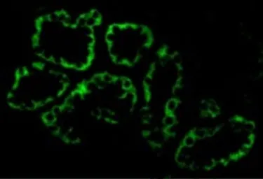 Anti-ACE2 antibody used in Immunocytochemistry/ Immunofluorescence (ICC/IF). GTX15349