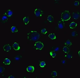 Anti-ACE2 antibody used in Immunocytochemistry/ Immunofluorescence (ICC/IF). GTX15349