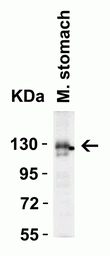 Anti-ACE2 antibody used in Western Blot (WB). GTX15349