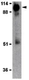 Anti-ACE2 antibody used in Western Blot (WB). GTX15349