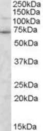 Anti-Syntrophin gamma 2 antibody, C-term used in Western Blot (WB). GTX15713