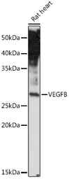 Anti-VEGFB antibody used in Western Blot (WB). GTX16404