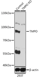 Anti-LAP2 antibody used in Western Blot (WB). GTX16410