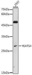 Anti-GAS41 antibody used in Western Blot (WB). GTX16452