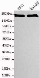 Anti-BRG1 antibody [4E11-E11-G11] used in Western Blot (WB). GTX16472