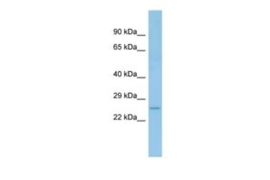 Anti-ACOT6 antibody, C-term used in Western Blot (WB). GTX16558