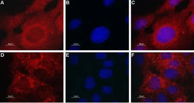 Anti-Mcoln2 antibody used in Immunocytochemistry/ Immunofluorescence (ICC/IF). GTX16616