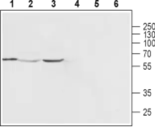 Anti-Mcoln2 antibody used in Western Blot (WB). GTX16616