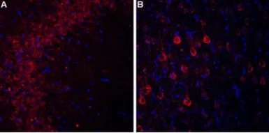 Anti-Cav alpha 2/delta 3 antibody used in IHC (Frozen sections) (IHC-Fr). GTX16618