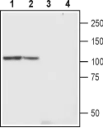 Anti-TRPC4 antibody used in Western Blot (WB). GTX16627