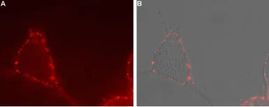 Anti-TRPV4 antibody used in Live cell imaging (LCI). GTX16630