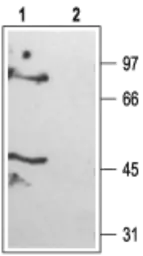 Anti-KCNK6 antibody used in Western Blot (WB). GTX16650