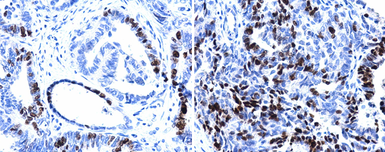 Anti-Ki67 antibody [SP6] used in IHC (Paraffin sections) (IHC-P). GTX16667