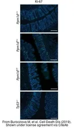 Anti-Ki67 antibody [SP6] used in IHC (Paraffin sections) (IHC-P). GTX16667