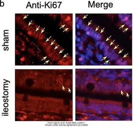 Anti-Ki67 antibody [SP6] used in IHC (Paraffin sections) (IHC-P). GTX16667