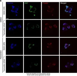 Anti-Ki67 antibody [SP6] used in IHC (Paraffin sections) (IHC-P). GTX16667