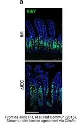 Anti-Ki67 antibody [SP6] used in IHC (Paraffin sections) (IHC-P). GTX16667