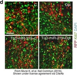 Anti-Ki67 antibody [SP6] used in Immunohistochemistry (IHC). GTX16667