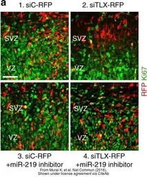 Anti-Ki67 antibody [SP6] used in Immunohistochemistry (IHC). GTX16667