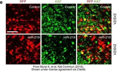 Anti-Ki67 antibody [SP6] used in Immunohistochemistry (IHC). GTX16667