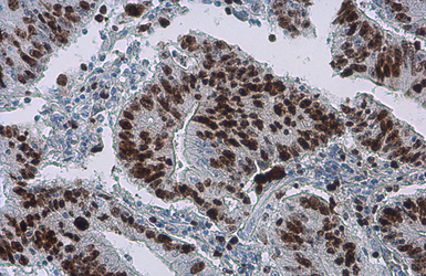 Anti-Ki67 antibody [SP6] used in IHC (Paraffin sections) (IHC-P). GTX16667