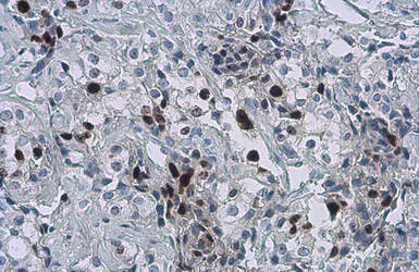 Anti-Ki67 antibody [SP6] used in IHC (Paraffin sections) (IHC-P). GTX16667