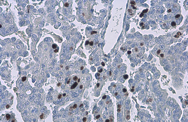 Anti-Ki67 antibody [SP6] used in IHC (Paraffin sections) (IHC-P). GTX16667