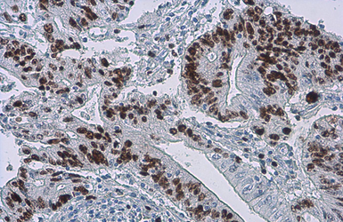 Anti-Ki67 antibody [SP6] used in IHC (Paraffin sections) (IHC-P). GTX16667