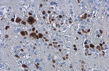 Anti-Ki67 antibody [SP6] used in IHC (Paraffin sections) (IHC-P). GTX16667