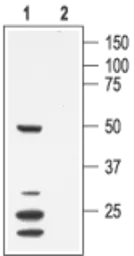 Anti-KCNA7 antibody used in Western Blot (WB). GTX16668