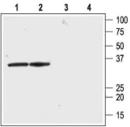 Anti-KCNAB2 antibody used in Western Blot (WB). GTX16689