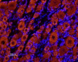 Anti-TRESK antibody used in IHC (Frozen sections) (IHC-Fr). GTX16694